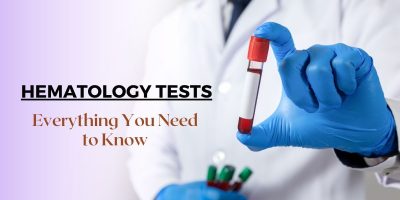 Hematology Department